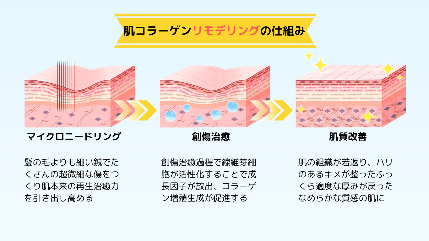 肌の修復作用機序